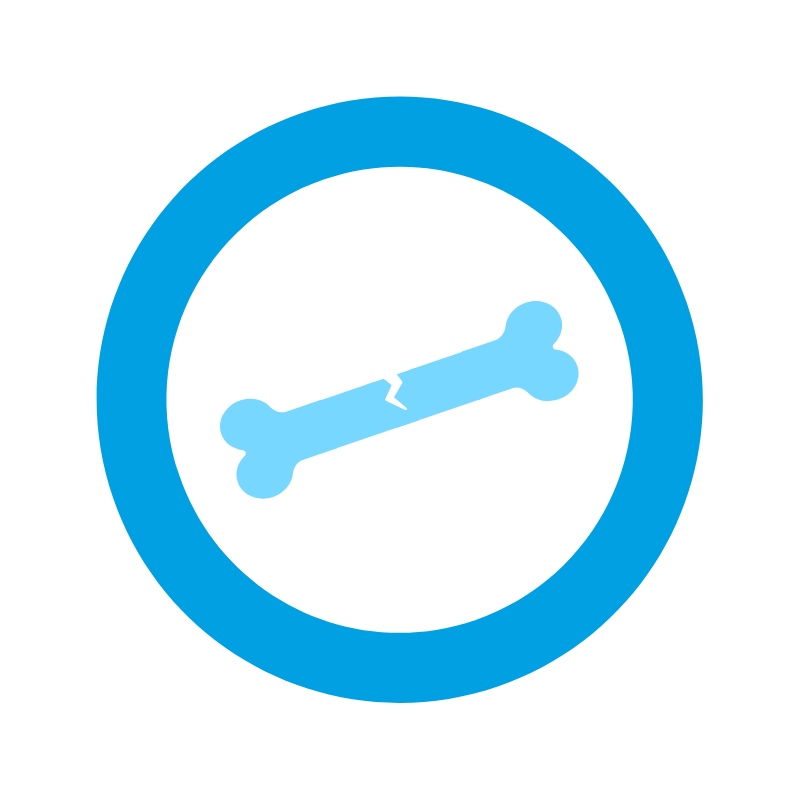 Przebyte złamania stanowią jeden z elementów, które powinny skłonić do badania gęstości kości.